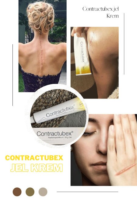 Contractubex; effective as a cream for the improvement of acne, skin blemishes, stretch marks, surgical scars and scars.