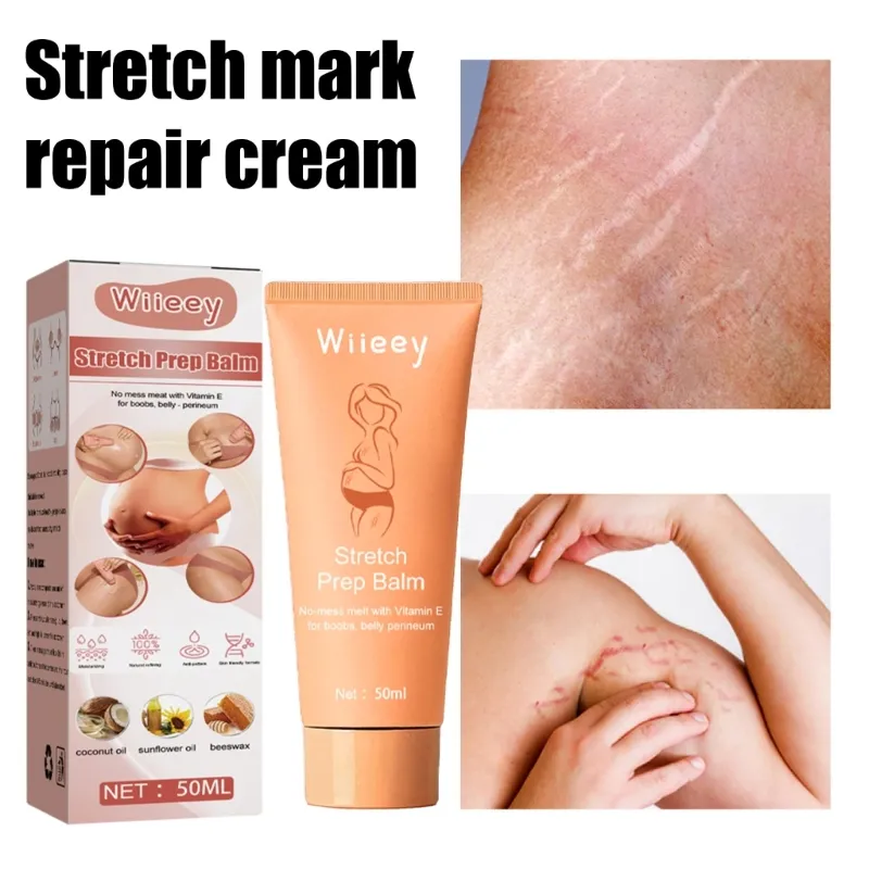 Pregnancy Removal Cream Pregnant Women Pigments Correction Repair Body