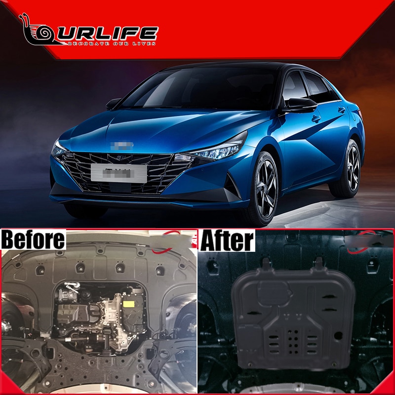 Engine Baffle Protection Plate Lower Guard Plate Engine Shield For Hyundai Elantra CN7 1.4T 1.5L 1.6L 2020 2021 2022 Accessories