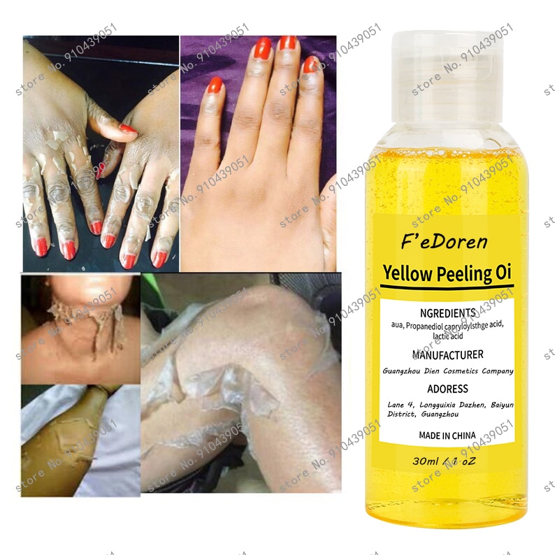 Thai yellow peeling oil bleaching Dark skin retinol with peptide Spots Blackheads Blemishes Bad Skin Spot Treatment