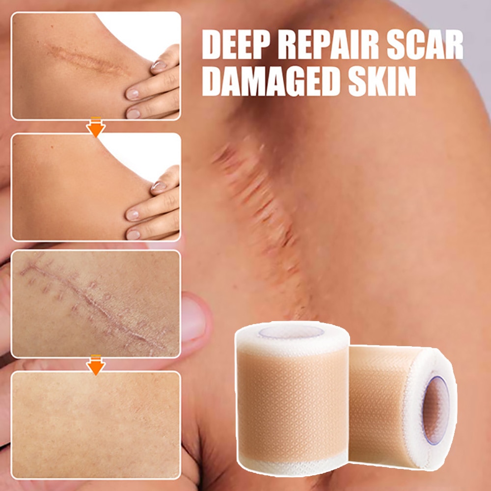 Beauty Scar Sheet Patch Silicone Gel 4x50cm Treatment Removal Tape Acne Trauma Burn Scar Cover Skin Repair Caesarean Section Ear
