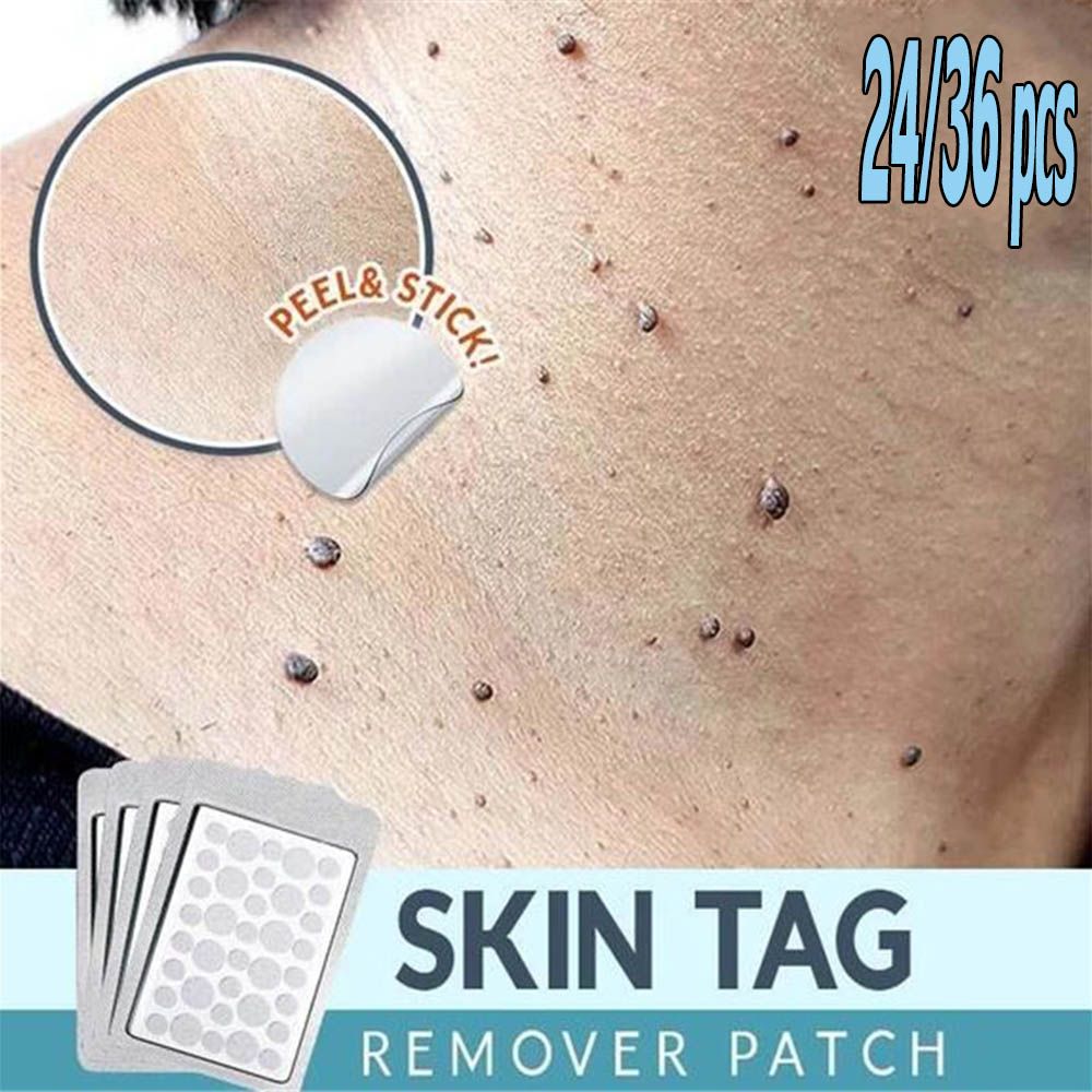 1Bag Skin Tag Remover Patch Ance Pimple Patch Plaster Acne Cream Invisible Hydrocolloid Master Anti-infection Absorb Face Care
