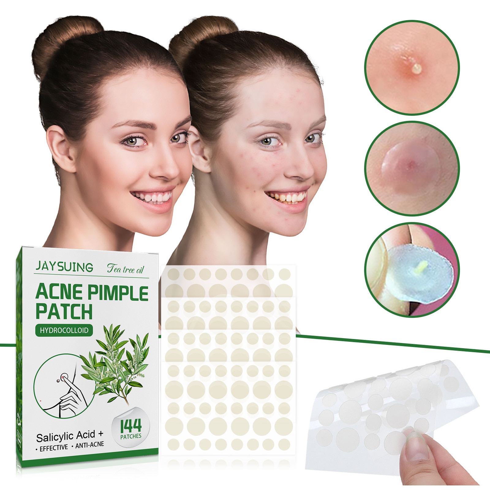 144 Patches Acne Pimple Patch Face Invisible Stickers Quick Effect Treatment Removing Patches Beauty Acne Tools Face Skin Care