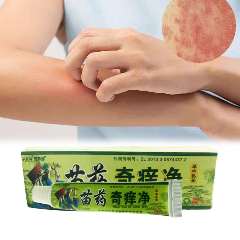 ZB Professional Treatment of Psoriasis Dermatitis Eczema Urticaria Beriberi Eczma Cream Chinese Herbal Plaster Skin Care