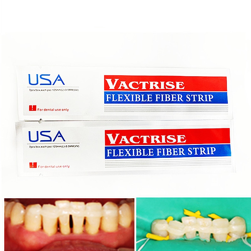 Dental Material USA Glass Splint Loose Tooth Fixation Strip Light Cure Bonding Flexible Fiber Band