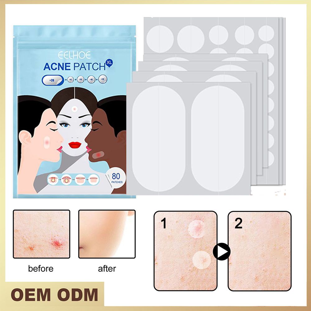 80Pcs Acne Pimple Patches Skin Tag Remover Patch Tea Tree Calendula Oil Acne Spot Treatment Facial Mask Hydrocolloid Bandages
