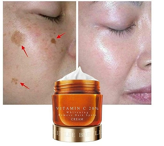 Vitamin C 20% VC Face Whitening Freckles Cream Remove Dark Spots Acne Marks Whitening Melanin Remover Brightening Face Cream