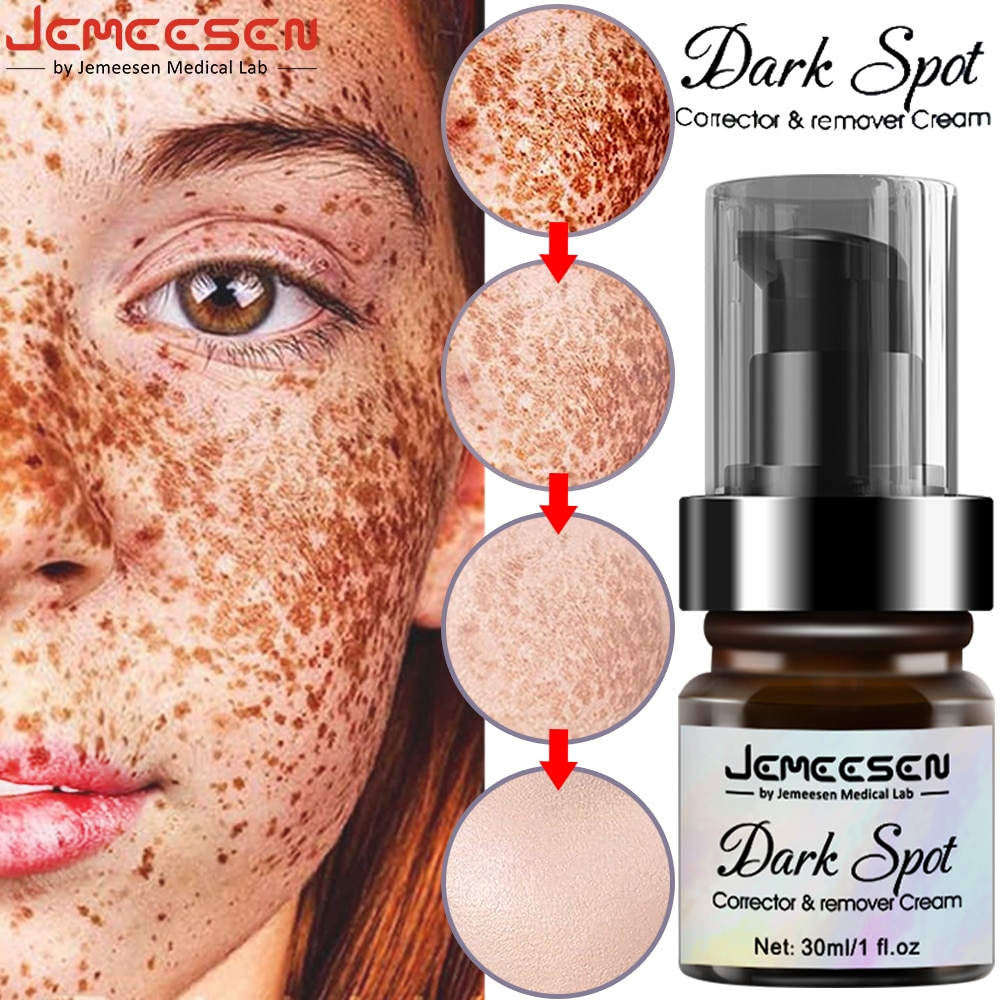 Jemeesen Freckle Whitening Cream Brighten Fade Dark Spot Corrector Removal Pigment Melanin Correcting Beauty Face Skin Care 30ML