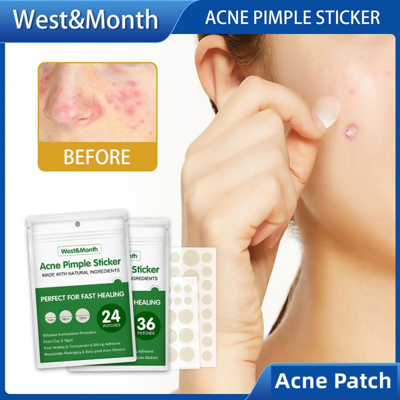 Invisible Acne Pimple Patch Acne Treatment Pimple Remover Tool Absorb Pus Without Scar Acne Cleaner Stickers Korean Skin Care