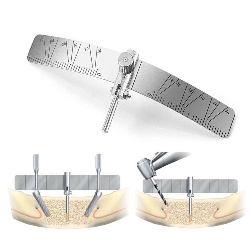 Dental Measuring Ruler Implant Locating Guide Surgical Planting Positioning Locator Angle Ruler Guage Autoclavable