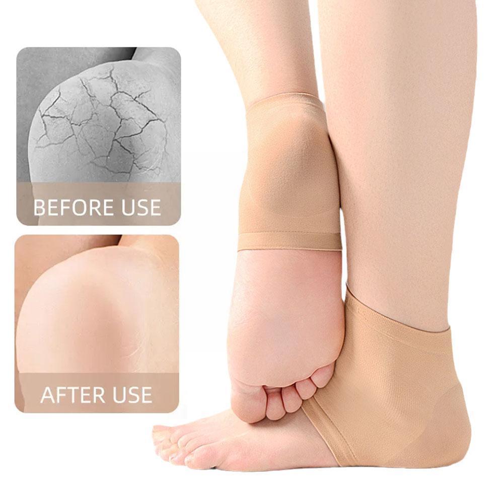 1 Pair Silicone Heel Protector Sleeve Heel Pads For Relief Plantar Fasciitis Heel Pain Reduce Pressure On Heel Half-yard So X1G5