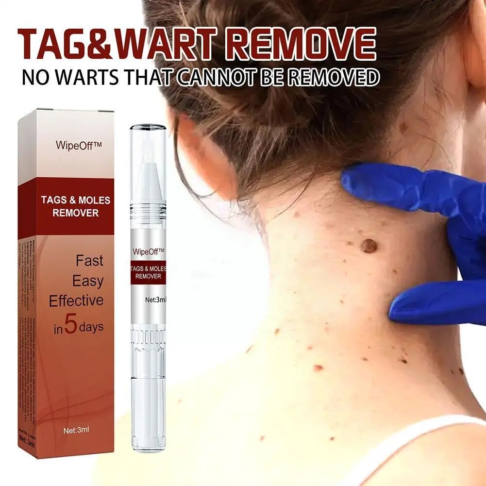 Tags Moles Remover Skincare Warts Corn Treatment Pen Wart Remover Filiform Mole Acuminata Liquid Wart And Removal Care Thor R1S0