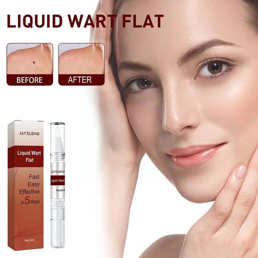 Skin Tags Removing Wart Treatment Pen Wart Acuminata Of Care And Removal Filiform Mole Wart Removal Thorn Warts Liquid Pen B3Y6