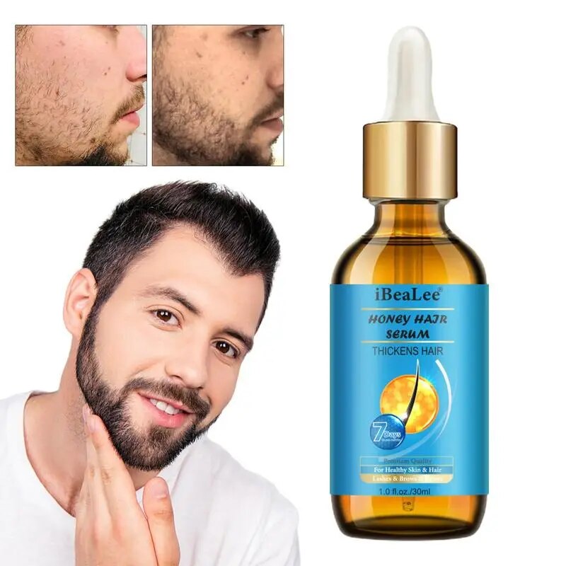 Scalp Oil Hair Growth 30ml Repairing Ginger Hair Growth Oil Nourishing Liquid Hair Growth Essential Oil For Women Men With Oily