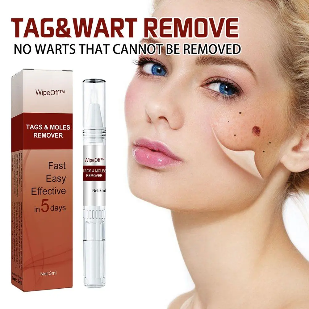 3ml Liquid Wipe Off Tags & Moles Pen For Hand Foot Callus Gram Warts Remover Liquid Genital Wart Removal Treatment Pen Skin 