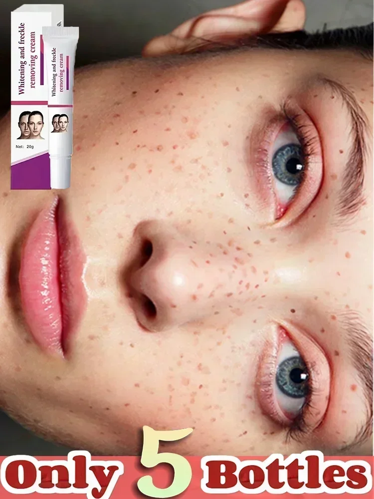 Remove Dark Spots Whitening Freckle Cream Effective Remove Melasma Melanin Moisturize Brighten Smooth Face Cream Skin Care