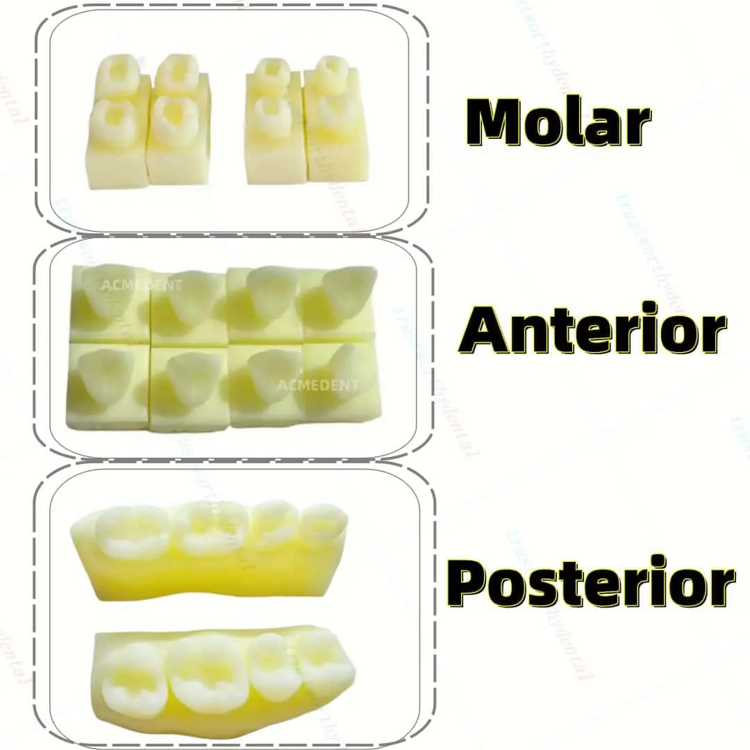 3Sets Dental Caries Decay Teeth Model Composite Restore Template Anterior Molar