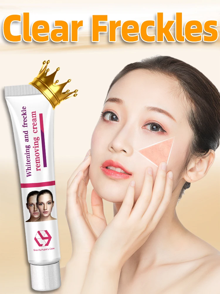 Freckles Dark Sun Age Spot Chloasma Diminish