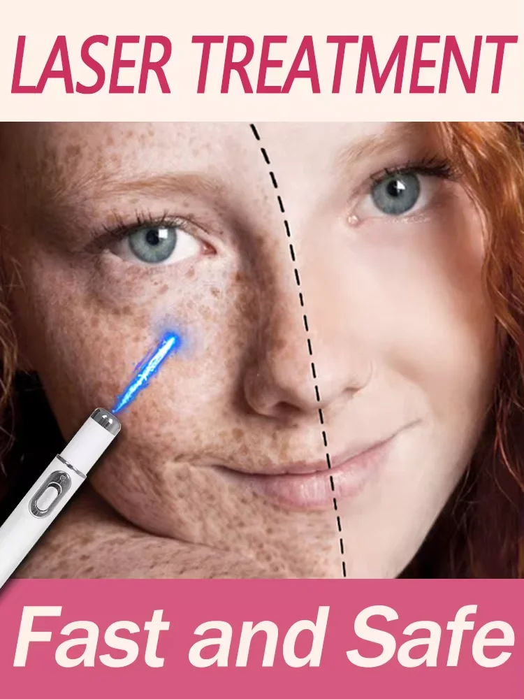 Clear Freckles Sun Age Dark Spot