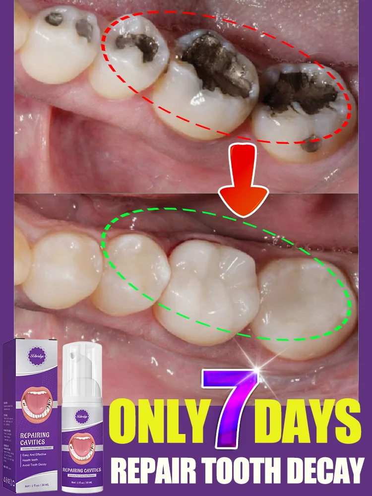 Solve all your dental problems!