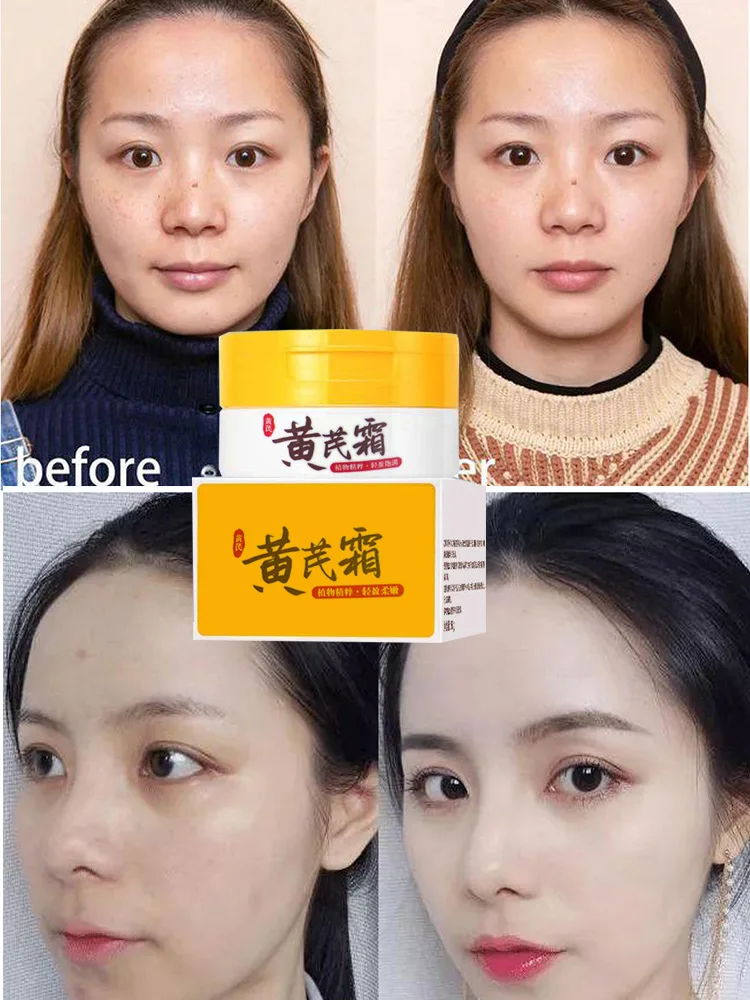 Chinese Astragalus Whitening Freckles Cream Remove Melasma Dark Spot Lightening Brighten