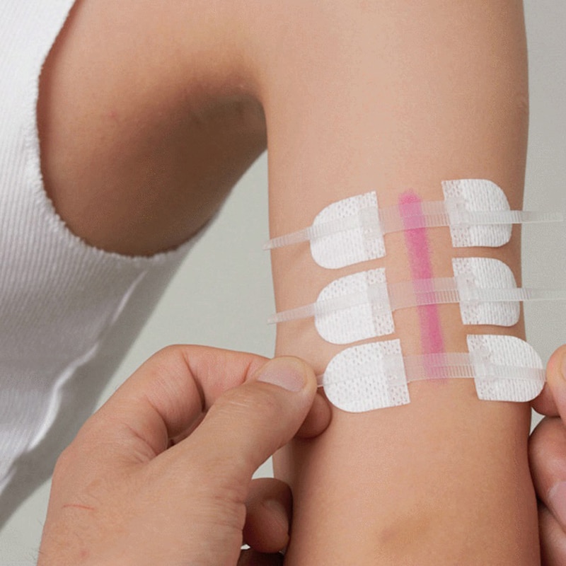 3Pcs/set Portable Zipper Tie Wound Closure Patch Self-Sticker Hemostatic Patch Wound Fast Suture Zipper Band-Aid Outdoor