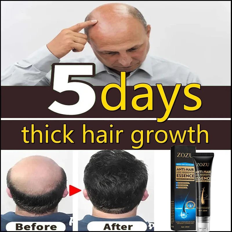 Fast Hair Growth Essence Effective Anti Hair Loss Prevent Hair Dry Frizzy Damaged Repair Scalp Hair