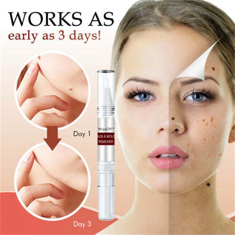 Blemish Removal Essences Fast Effective Remove Warts Essences Relieve Discomfort Portable Lightweight Easy Use For Remedy Skin