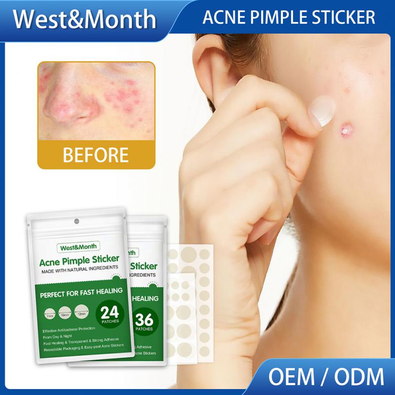 Acne Pimple Patch Stickers Acne Treatment Pimple Remover Tool Blemish Spot Facial Mask Skin Care Waterproof 36/24 Patches