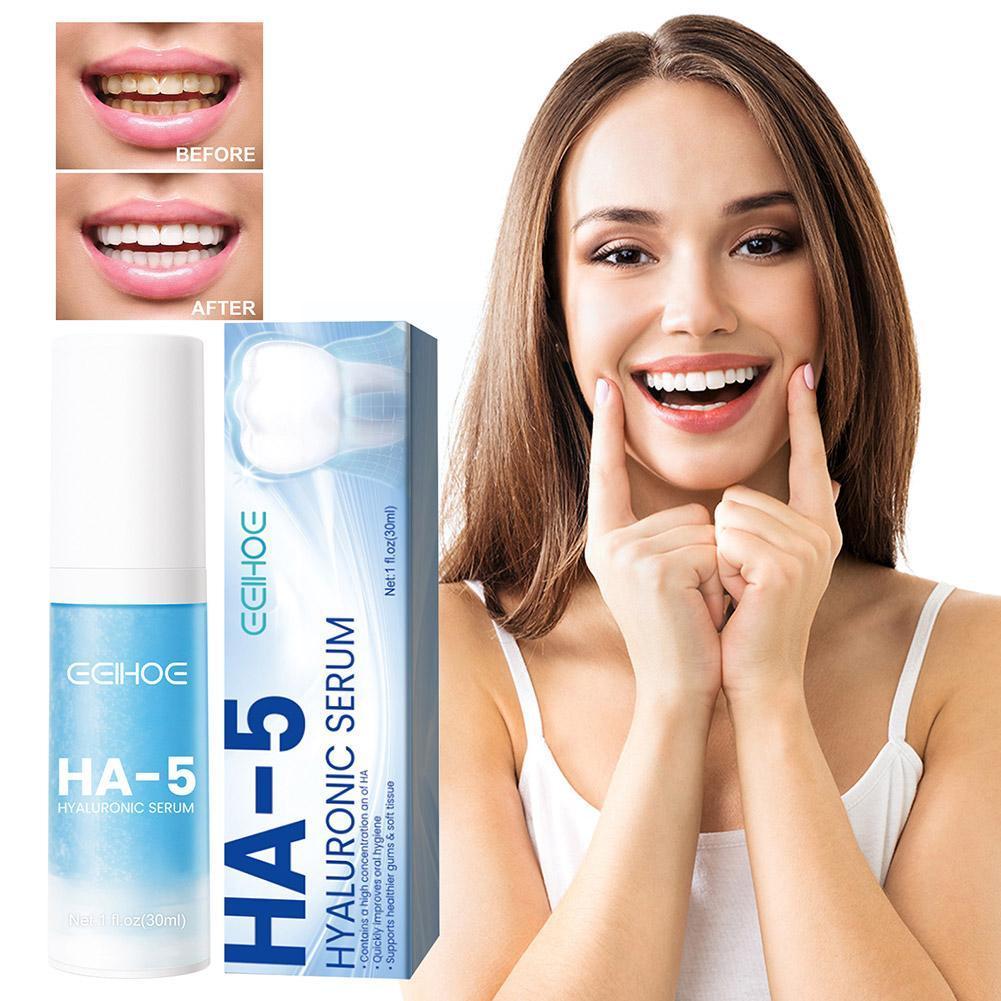 30ml Toothpaste Mousse Cleaning Whitening Remove Yellow Prevent And Hygiene Teeth Oral Remove Stains Decay Tooth Tooth Clea J6D5