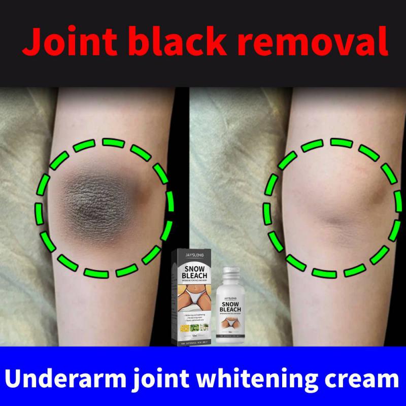 Whitening Cream For Dark Skin Armpit Lightening Intimate Areas Underarm Body Skin Care Underarm Thigh Whiten Cream Beauty