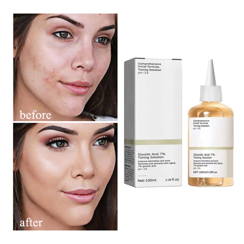 Glycolic Acid 7% Toning Solution Dispelling Acne Acne Remover Lifting Firming Wrinkles Glowing Facial Skin Care Acid Toner New