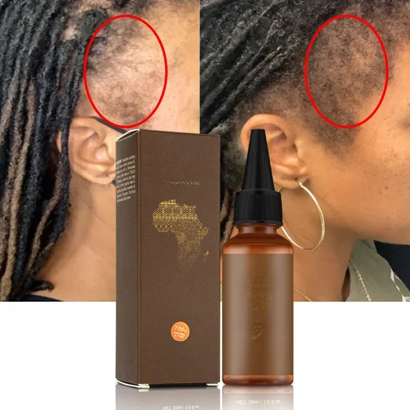 Hair Growth Chebe  Oil Anti-Hair Loss Treatment Fast Growing Products Repair Damage Dry Hair Care