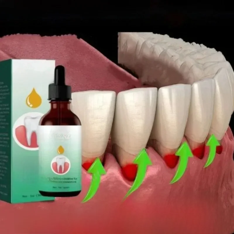 Gum Repair Drops Relieve Receding Gingival Swelling Gum Clean Care Oral Periodontal Hygiene Remove