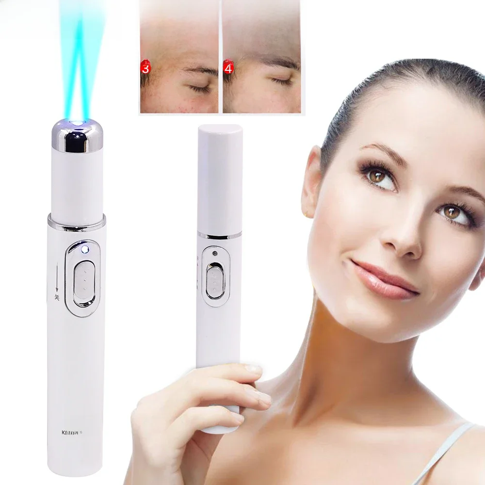 Blue Light Facial Machine Acne Wrinkle Removal Laser Pen Skin Spots Removal Anti Varicose Spider